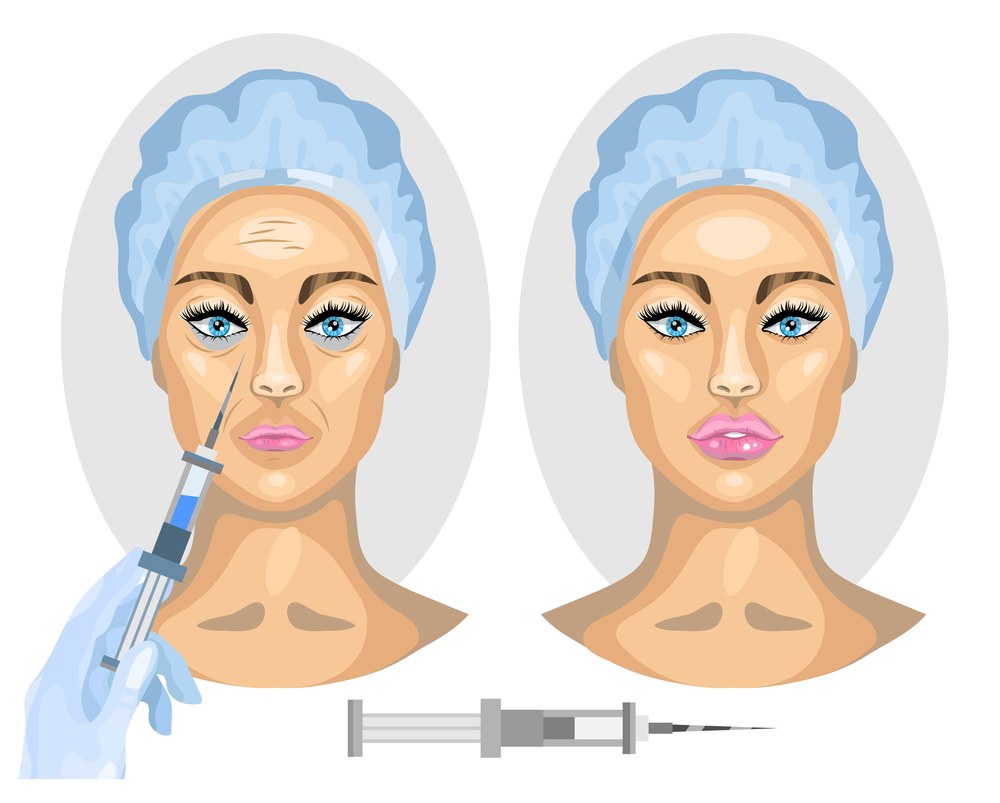 Před a po injekční aplikaci kyseliny hyaluronové