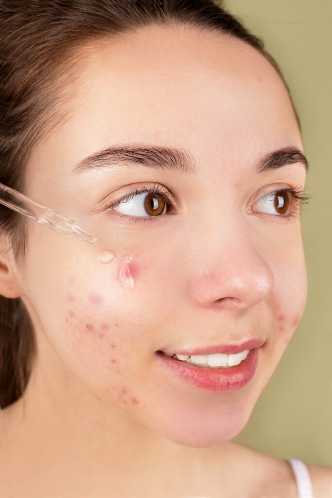 Woman Applying Facial Serum