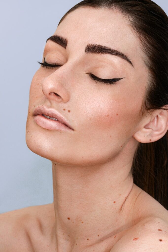 a woman with freckles on her face and neck